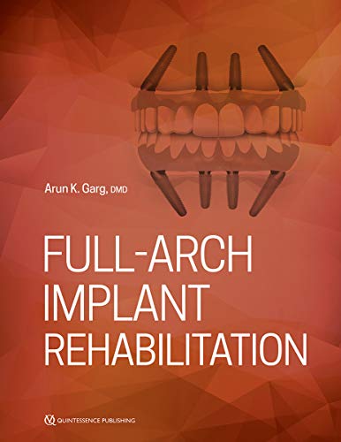 Algopix Similar Product 20 - Full-Arch Implant Rehabilitation