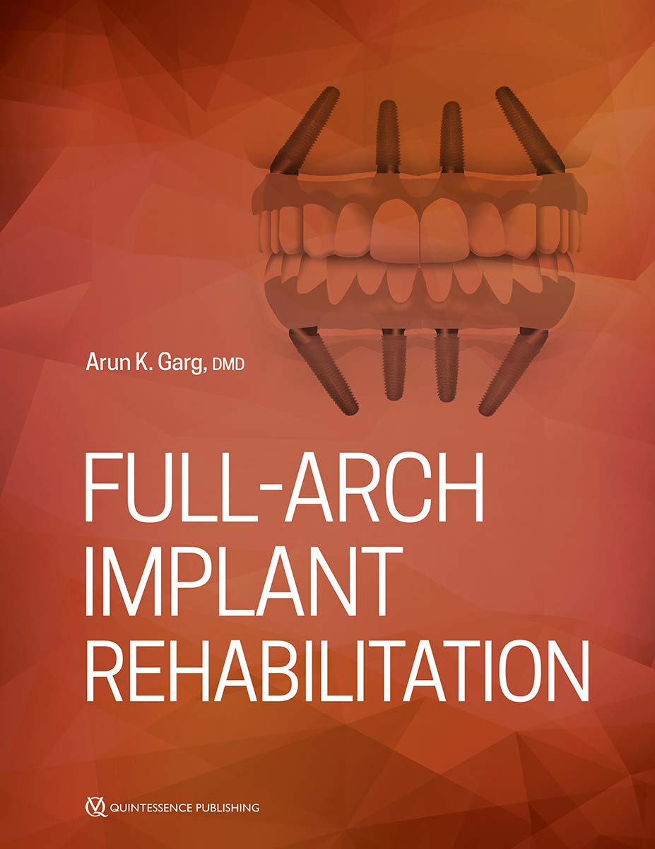 Algopix Similar Product 5 - Full-Arch Implant Rehabilitation