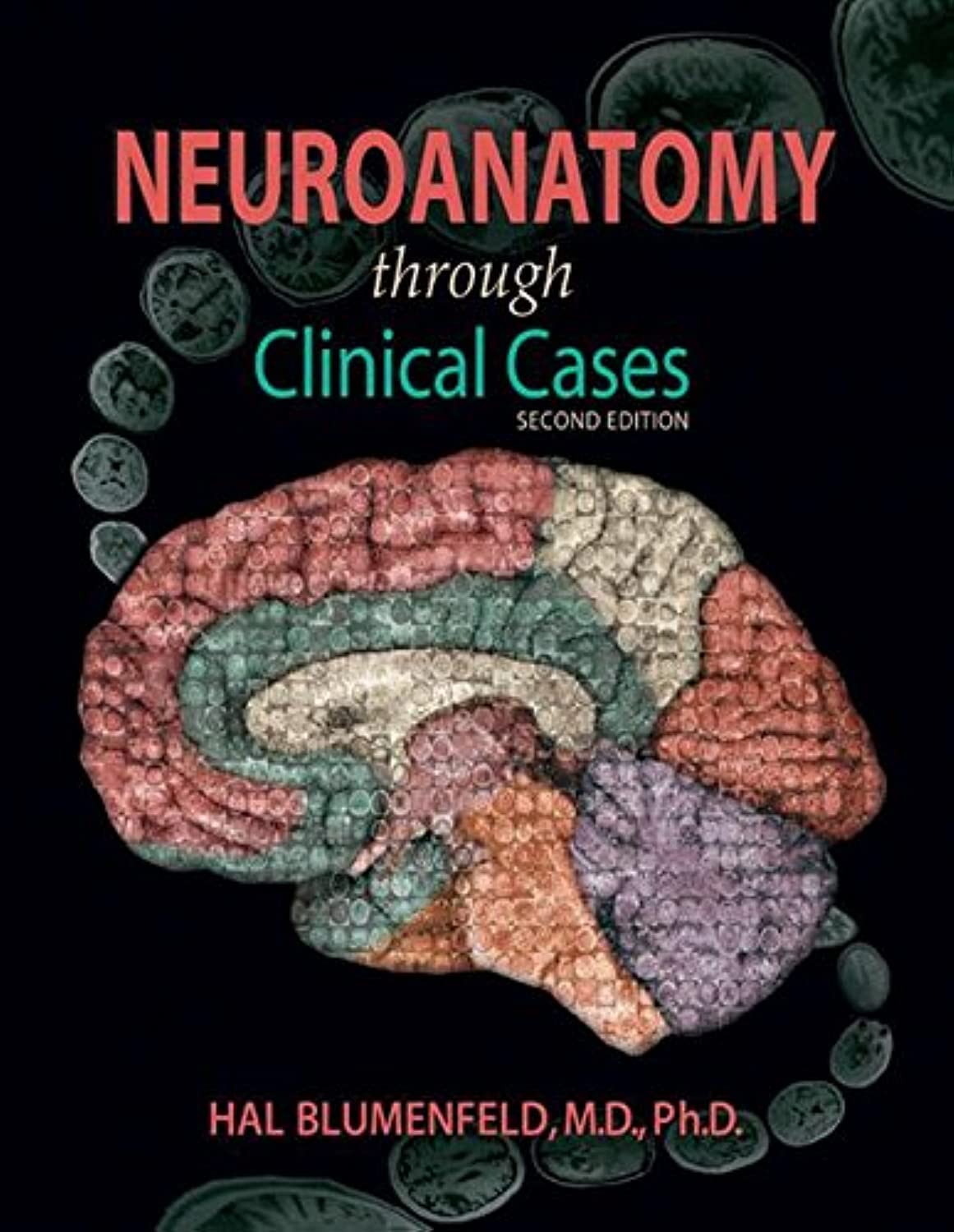 Algopix Similar Product 14 - Neuroanatomy through Clinical Cases