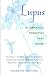 Algopix Similar Product 1 - Lupus: Alternative Therapies That Work