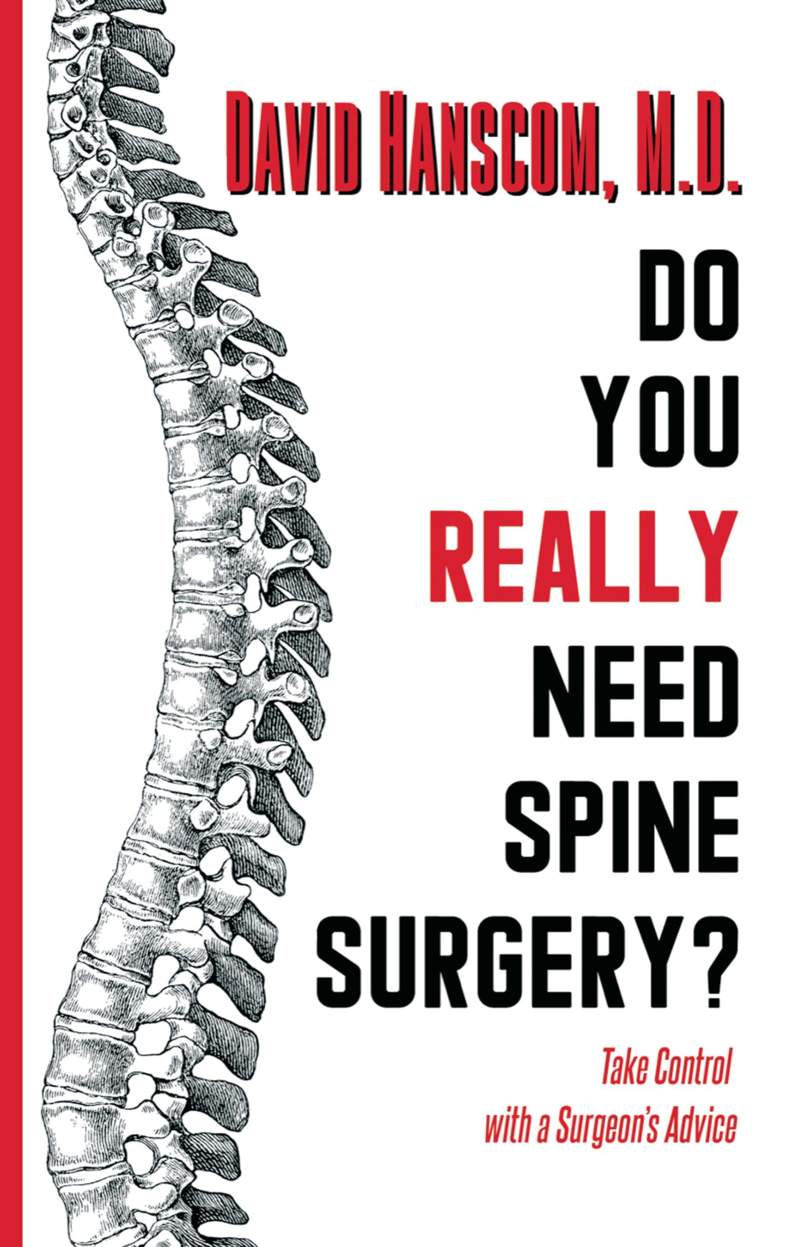Algopix Similar Product 5 - Do You Really Need Spine Surgery Take