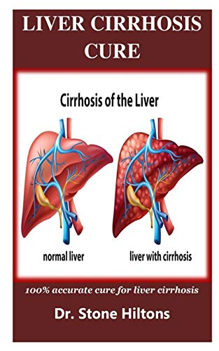 Algopix Similar Product 4 - Liver Cirrhosis Cure 100 accurate