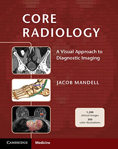Algopix Similar Product 2 - Core Radiology A Visual Approach to