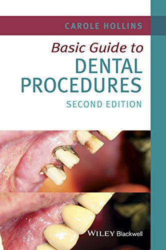 Algopix Similar Product 13 - Basic Guide to Dental Procedures Basic