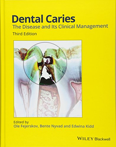 Algopix Similar Product 11 - Dental Caries The Disease and its