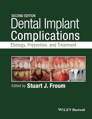 Algopix Similar Product 14 - Dental Implant Complications Etiology