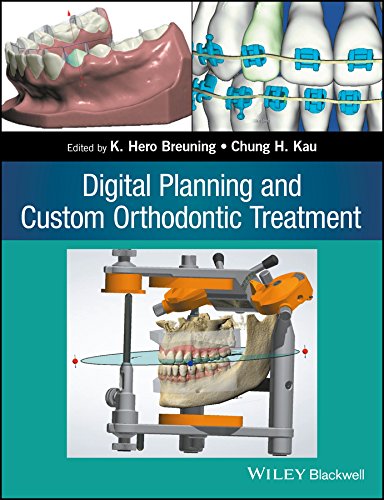 Algopix Similar Product 1 - Digital Planning and Custom Orthodontic