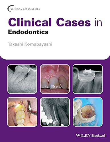 Algopix Similar Product 4 - Clinical Cases in Endodontics Clinical
