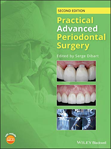 Algopix Similar Product 17 - Practical Advanced Periodontal Surgery