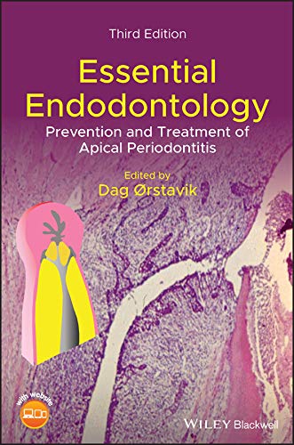 Algopix Similar Product 20 - Essential Endodontology Prevention and
