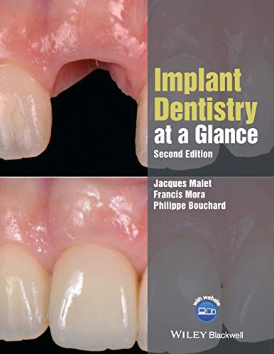 Algopix Similar Product 3 - Implant Dentistry at a Glance At a