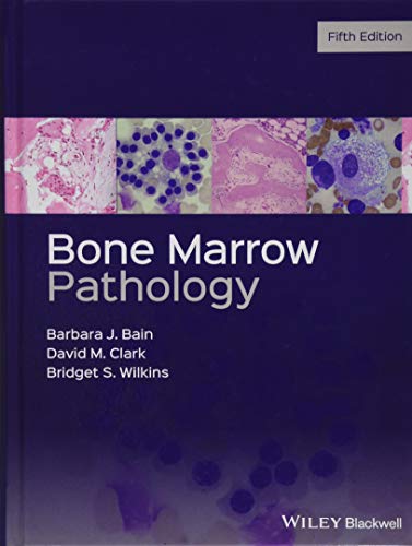 Algopix Similar Product 2 - Bone Marrow Pathology