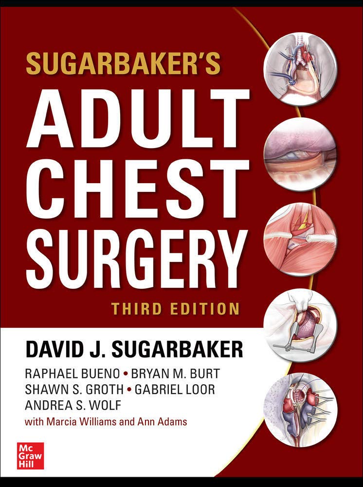 Algopix Similar Product 8 - Sugarbakers Adult Chest Surgery 3rd