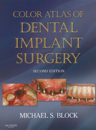 Algopix Similar Product 5 - Color Atlas of Dental Implant Surgery
