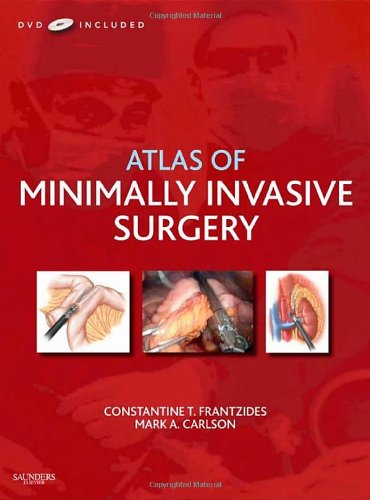 Algopix Similar Product 6 - Atlas of Minimally Invasive Surgery
