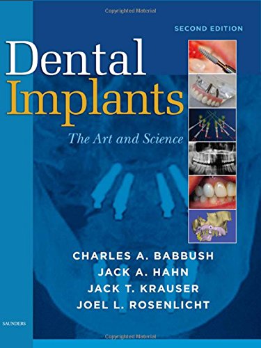 Algopix Similar Product 10 - Dental Implants: The Art and Science