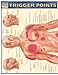 Algopix Similar Product 7 - Trigger Points QuickStudy Laminated