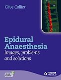 Algopix Similar Product 2 - Epidural Anaesthesia Images Problems