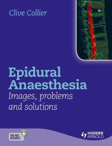 Algopix Similar Product 6 - Epidural Anaesthesia Images Problems