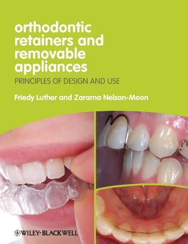 Algopix Similar Product 6 - Orthodontic Retainers and Removable