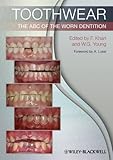 Algopix Similar Product 11 - Toothwear: The ABC of the Worn Dentition