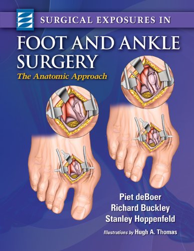 Algopix Similar Product 5 - Surgical Exposures in Foot  Ankle