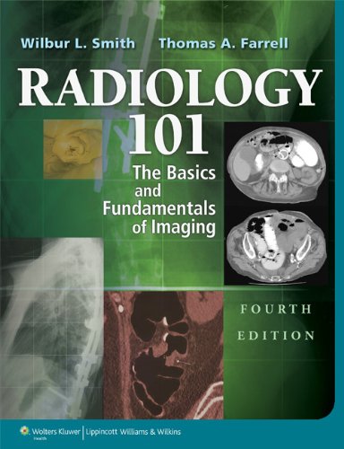 Algopix Similar Product 7 - Radiology 101 The Basics and