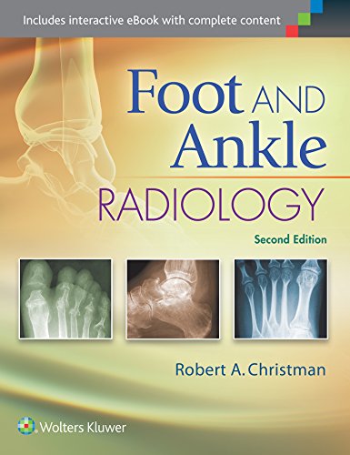 Algopix Similar Product 17 - Foot and Ankle Radiology