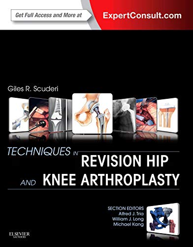 Algopix Similar Product 3 - Techniques in Revision Hip and Knee