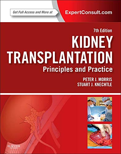 Algopix Similar Product 11 - Kidney Transplantation Principles and