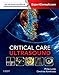 Algopix Similar Product 12 - Critical Care Ultrasound