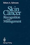 Algopix Similar Product 11 - Skin Cancer: Recognition and Management