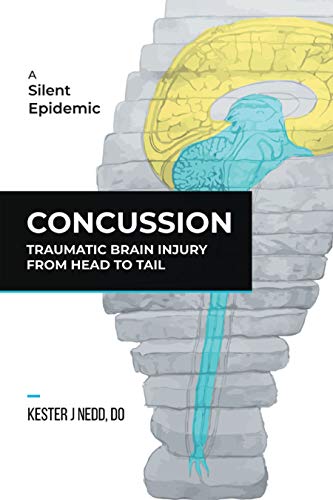 Algopix Similar Product 1 - Concussion Traumatic Brain Injury from