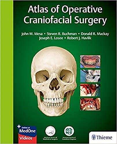 Algopix Similar Product 19 - Atlas of Operative Craniofacial Surgery