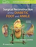 Algopix Similar Product 11 - Surgical Reconstruction of the Diabetic