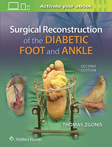 Algopix Similar Product 3 - Surgical Reconstruction of the Diabetic