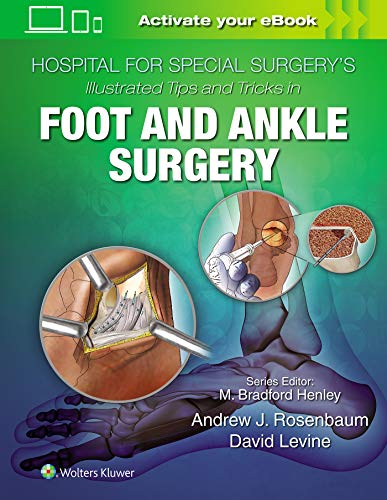 Algopix Similar Product 12 - Hospital for Special Surgerys