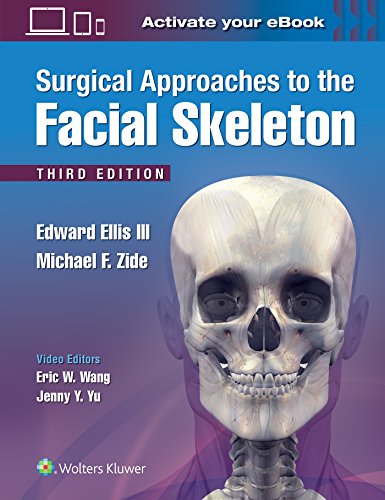 Algopix Similar Product 20 - Surgical Approaches to the Facial