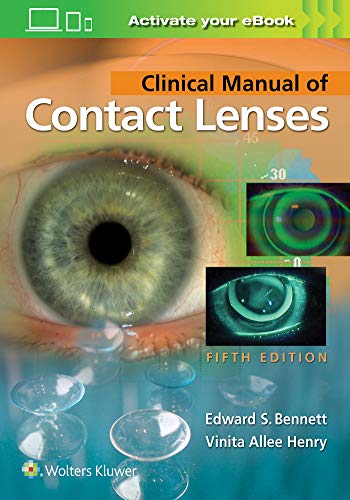 Algopix Similar Product 4 - Clinical Manual of Contact Lenses