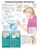 Algopix Similar Product 14 - Understanding Epilepsy Anatomical Chart