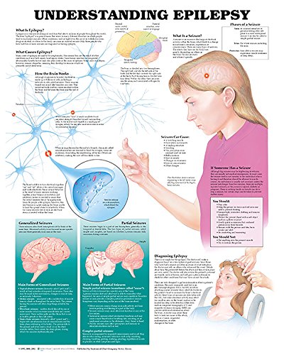 Algopix Similar Product 15 - Understanding Epilepsy Anatomical Chart