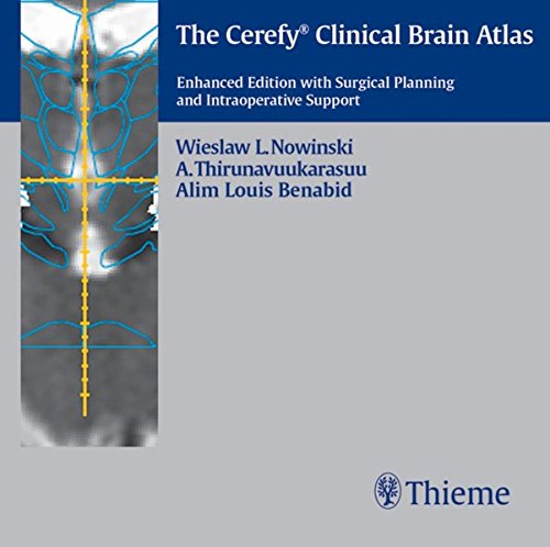 Algopix Similar Product 4 - The Cerefy Clinical Brain AtlasCDROM
