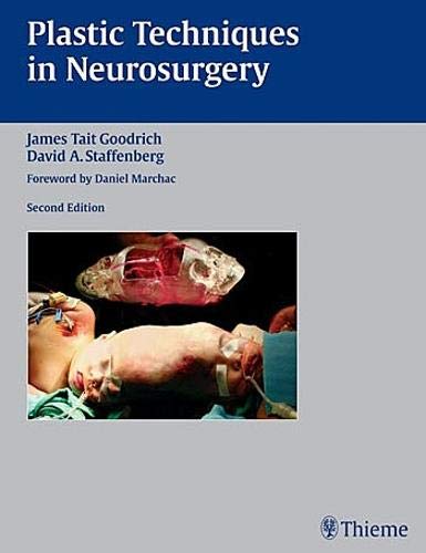 Algopix Similar Product 16 - Plastic Techniques in Neurosurgery