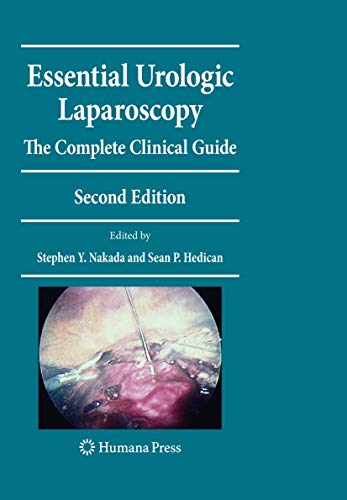 Algopix Similar Product 13 - Essential Urologic Laparoscopy The