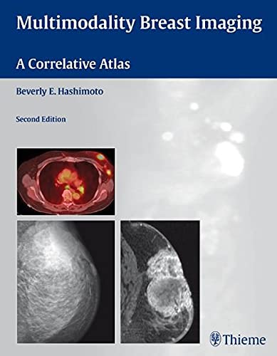 Algopix Similar Product 15 - Multimodality Breast Imaging A