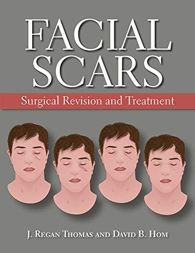 Algopix Similar Product 3 - Facial Scars Surgical Revision and
