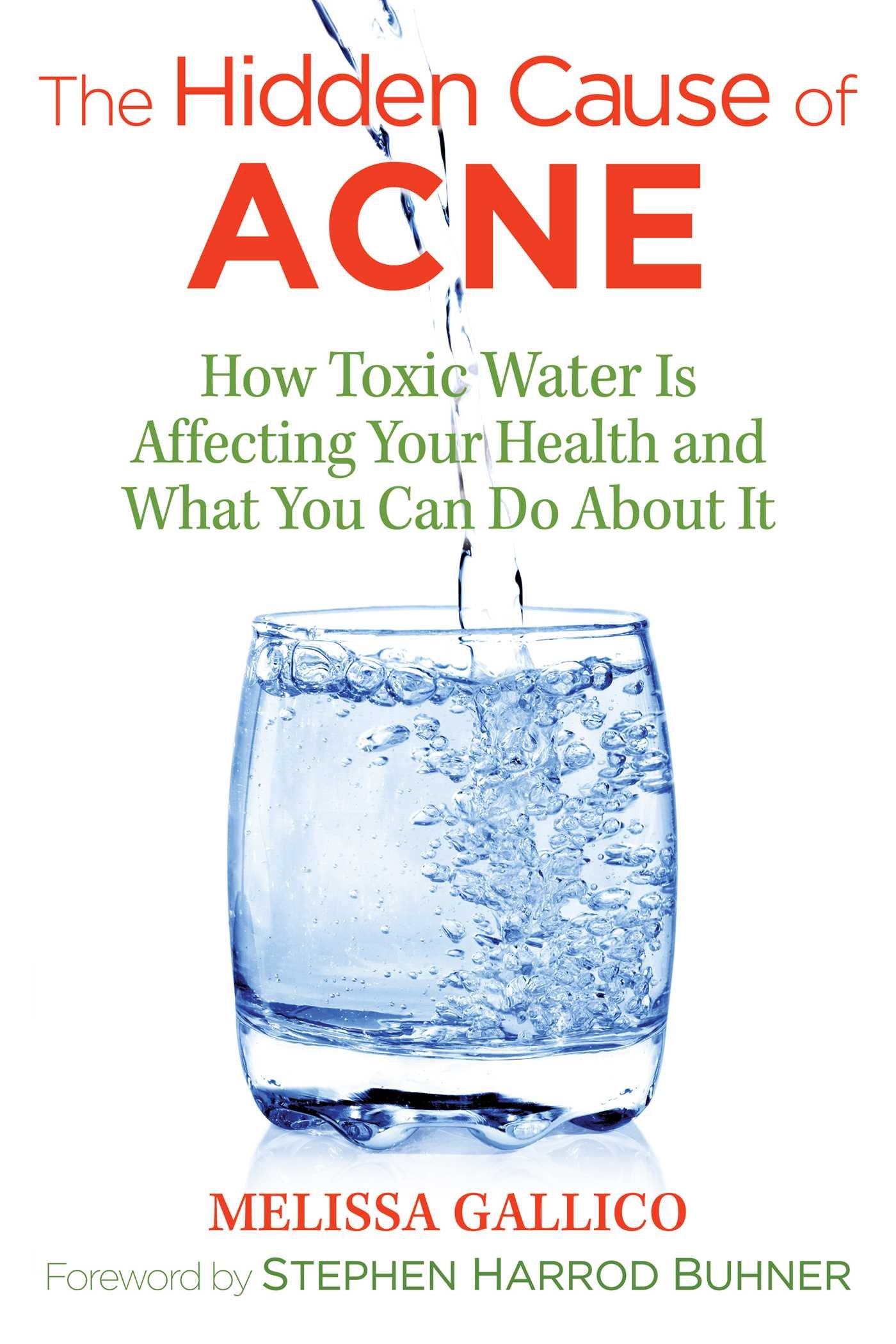 Algopix Similar Product 8 - The Hidden Cause of Acne How Toxic