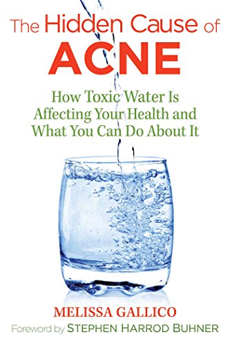 Algopix Similar Product 12 - The Hidden Cause of Acne How Toxic
