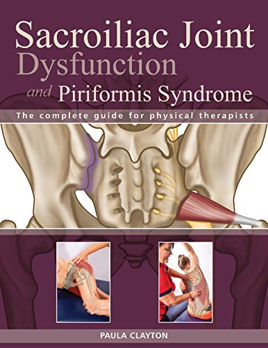 Algopix Similar Product 19 - Sacroiliac Joint Dysfunction and