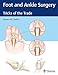 Algopix Similar Product 18 - Foot and Ankle Surgery Tricks of the
